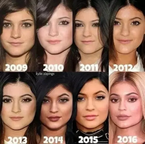 Kylie's micro-surgery process