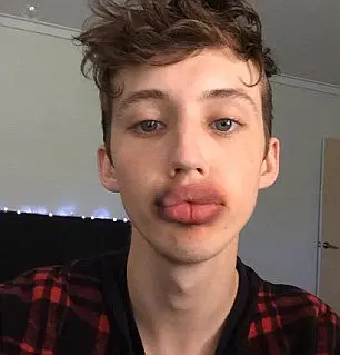 Troye Sivan participates #Kylie Jenner Challenge